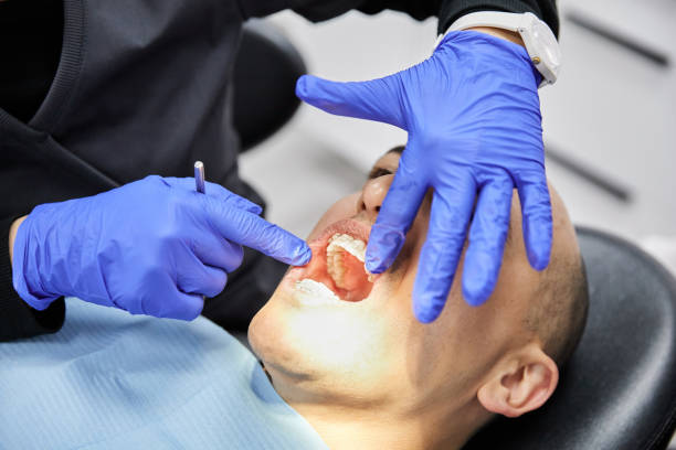 Best Chipped Tooth Repair Near Me  in Olivehurst, CA